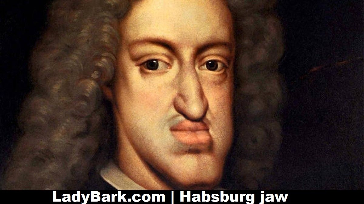 Habsburg Jaw: How It Appears in People Today